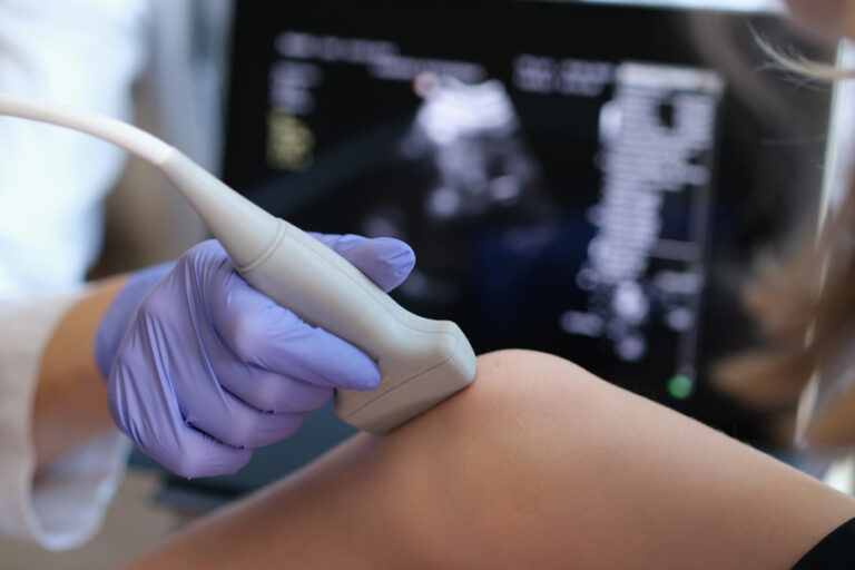 Ultrassom Doppler
