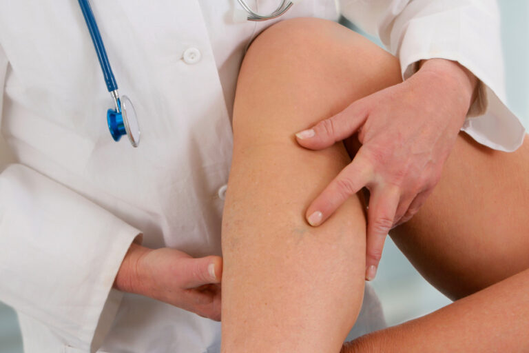 Tratamento para Lipedema